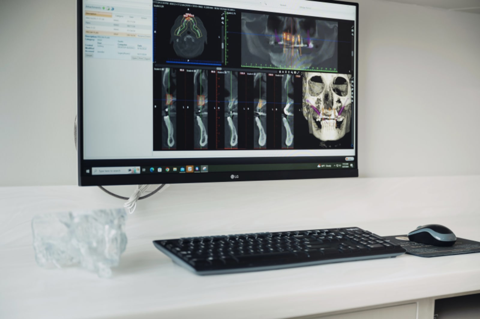 Hands holding dental imaging scan showing detailed x-ray analysis of treatment area