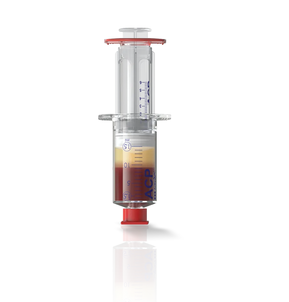 Close-up of the Arthrex ACP double syringe, showing fluid PRF separated from red blood components, to be used in skin rejuvenation procedures in clinics for aesthetic surgery.