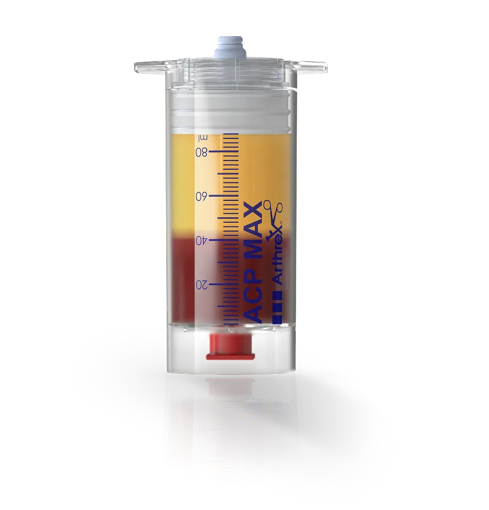 Close-up of the ACP Max system, a wide syringe-like device filled with highly concentrated PRP separated from other red blood components to be used in advanced dermatology and natural aesthetic medicine procedures.