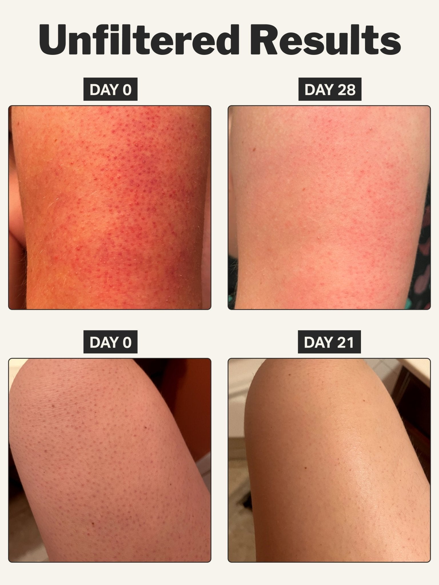 KP smoothing stick 6