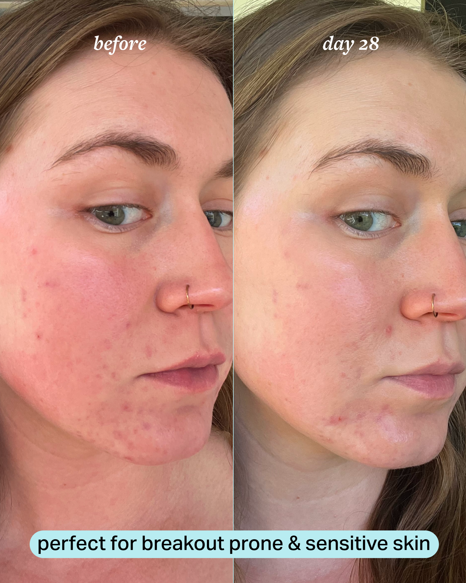 calming magnesium mist 3