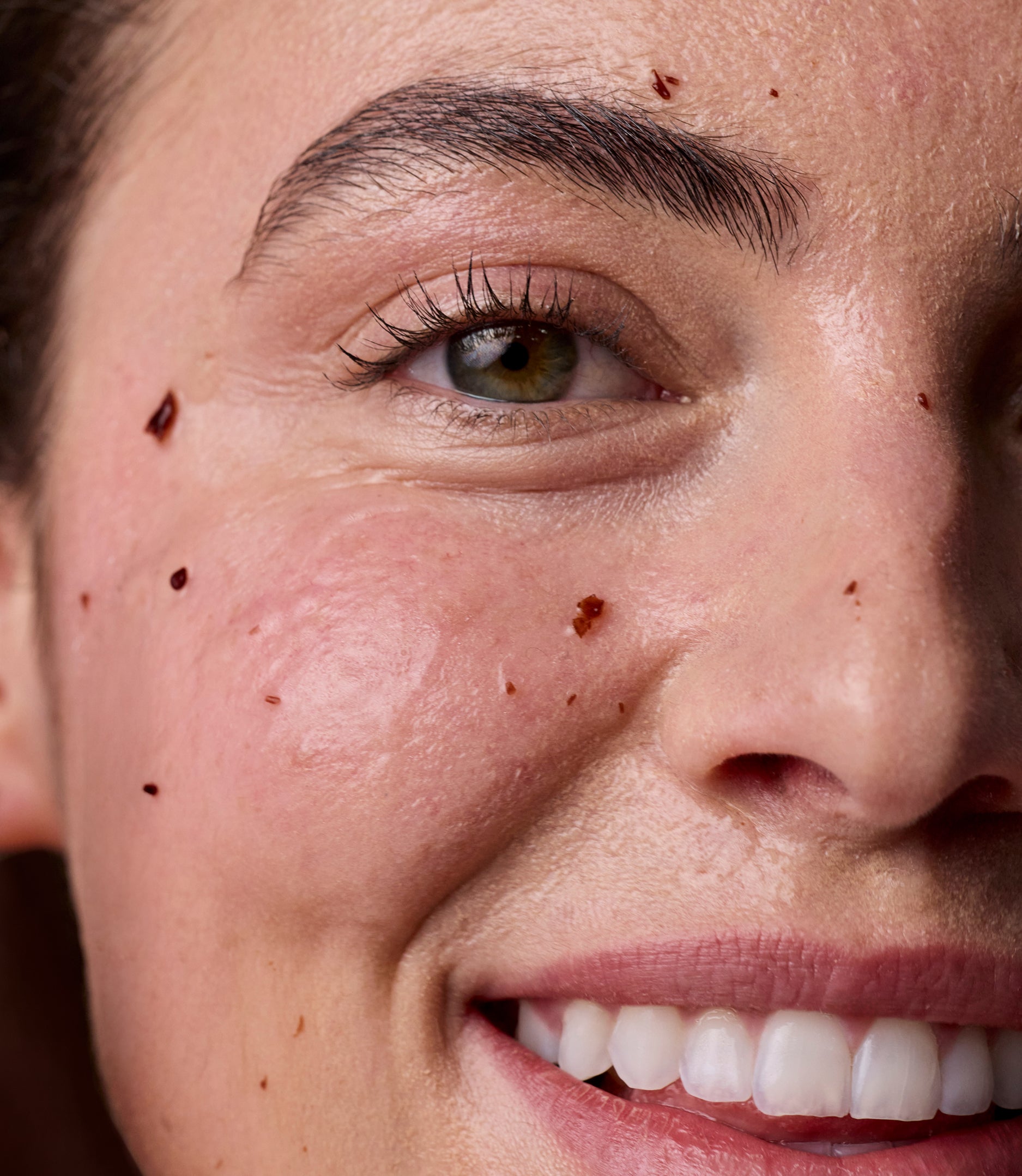 Zombie Cell Clarifying System 3