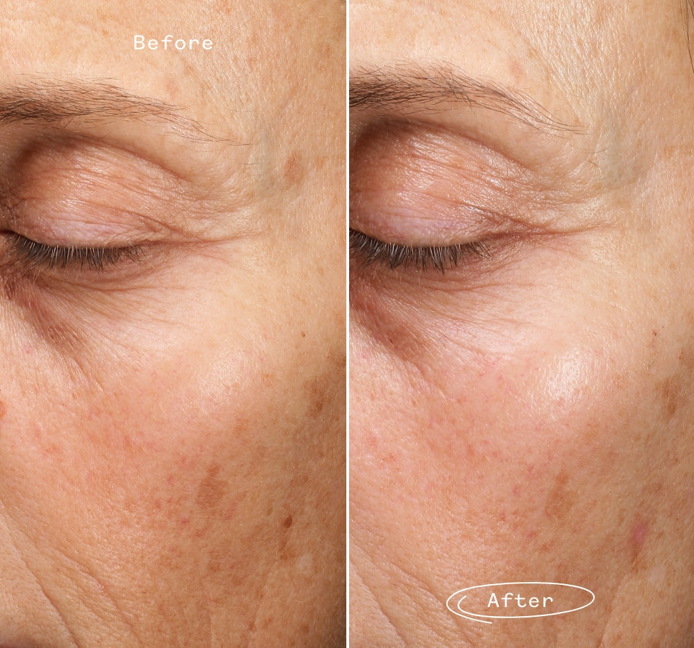 Fade Forward™ Serum 3