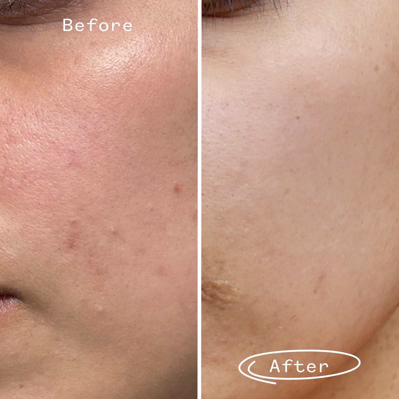 Tri-Mushroom 10% Super-Soothing Booster 5