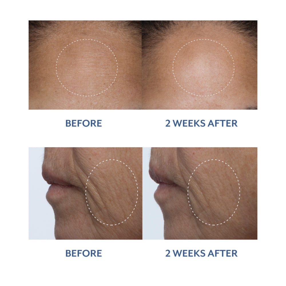 Black Tulip Facial Treatment 4