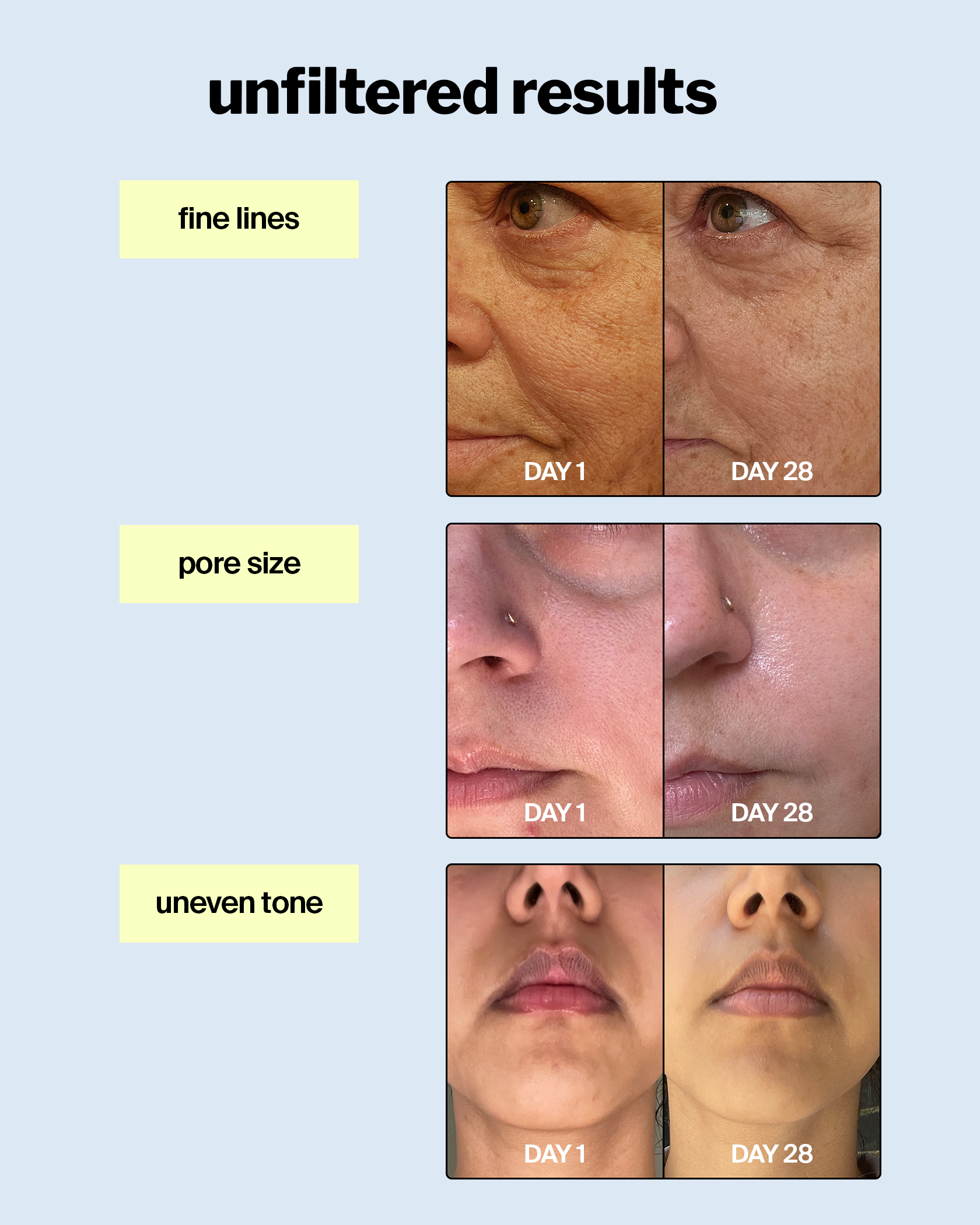 advanced retinol gel 0.5% 2