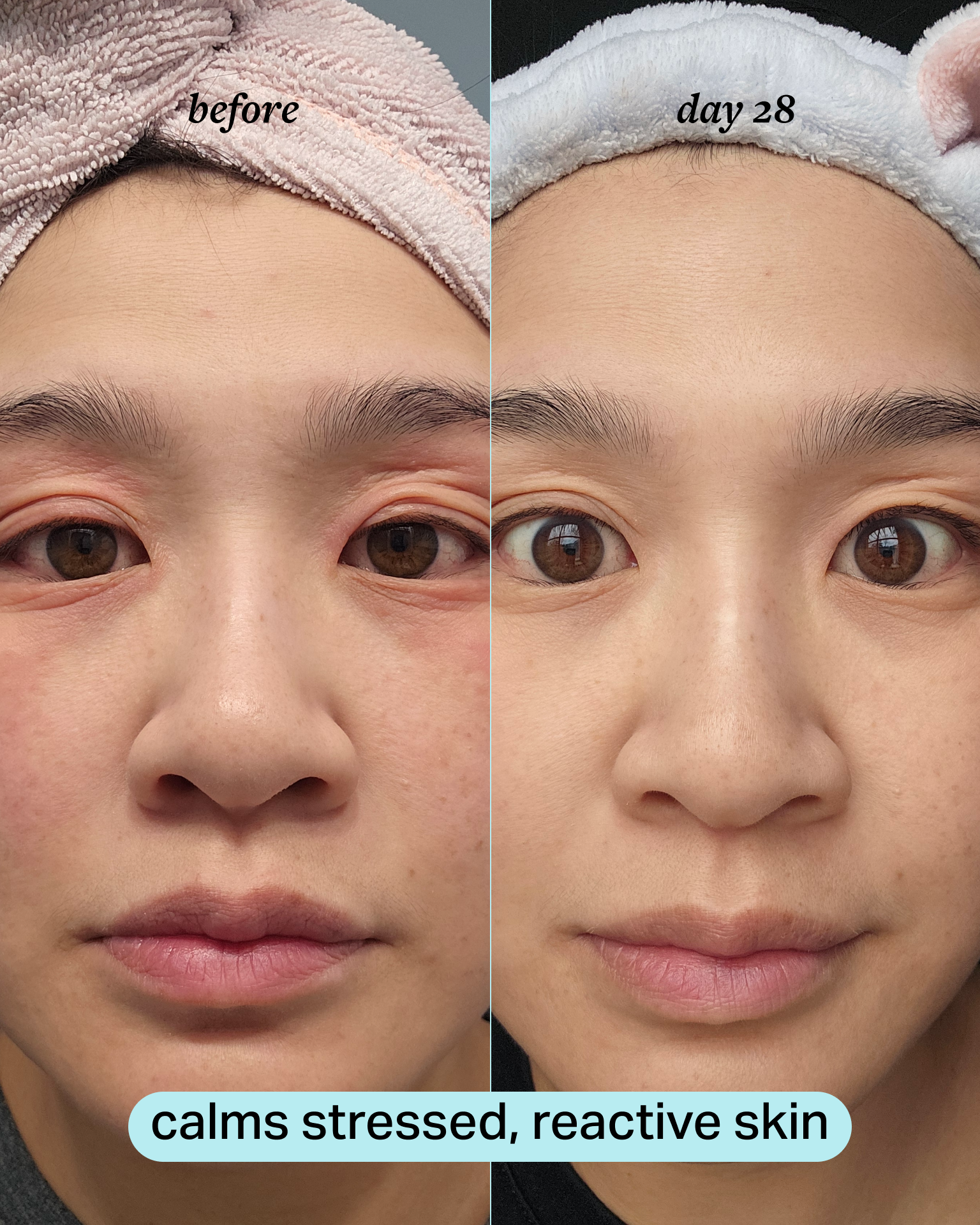 calming magnesium mist 5