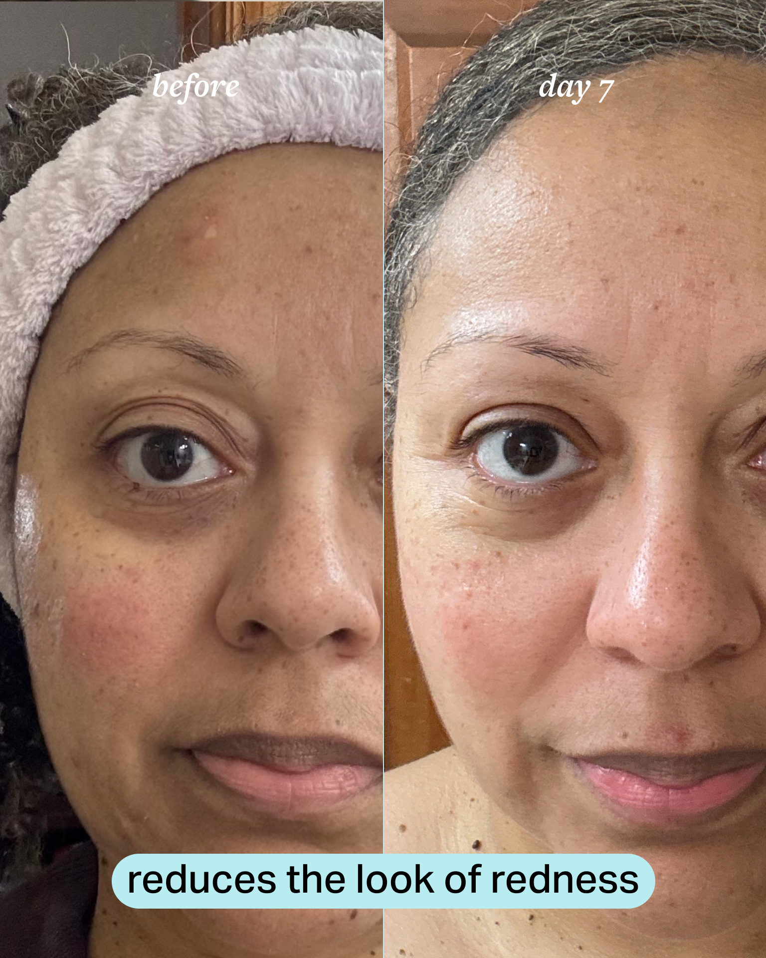 calming magnesium mist 4