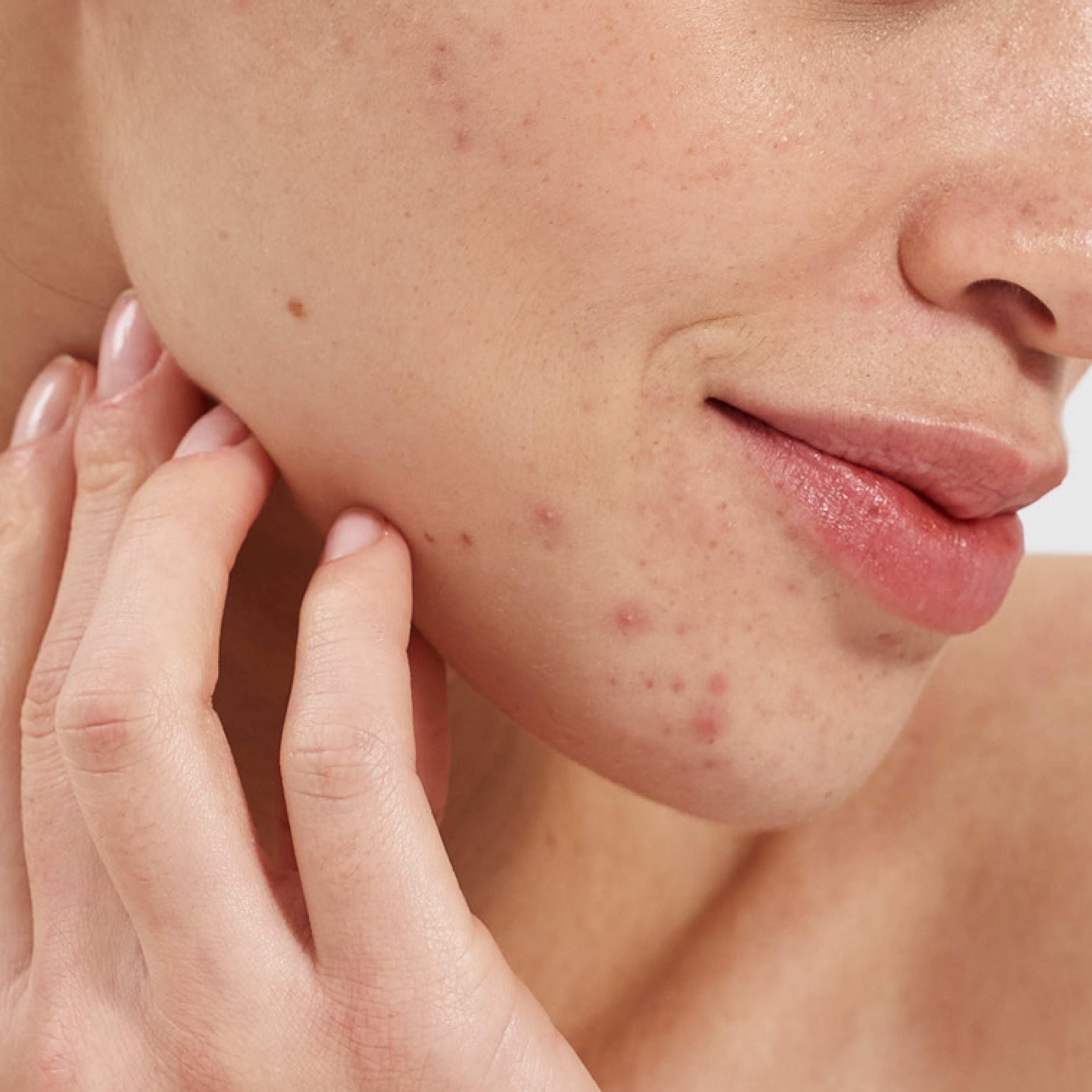 Salicylic Acid 2% Clarifying Booster 3