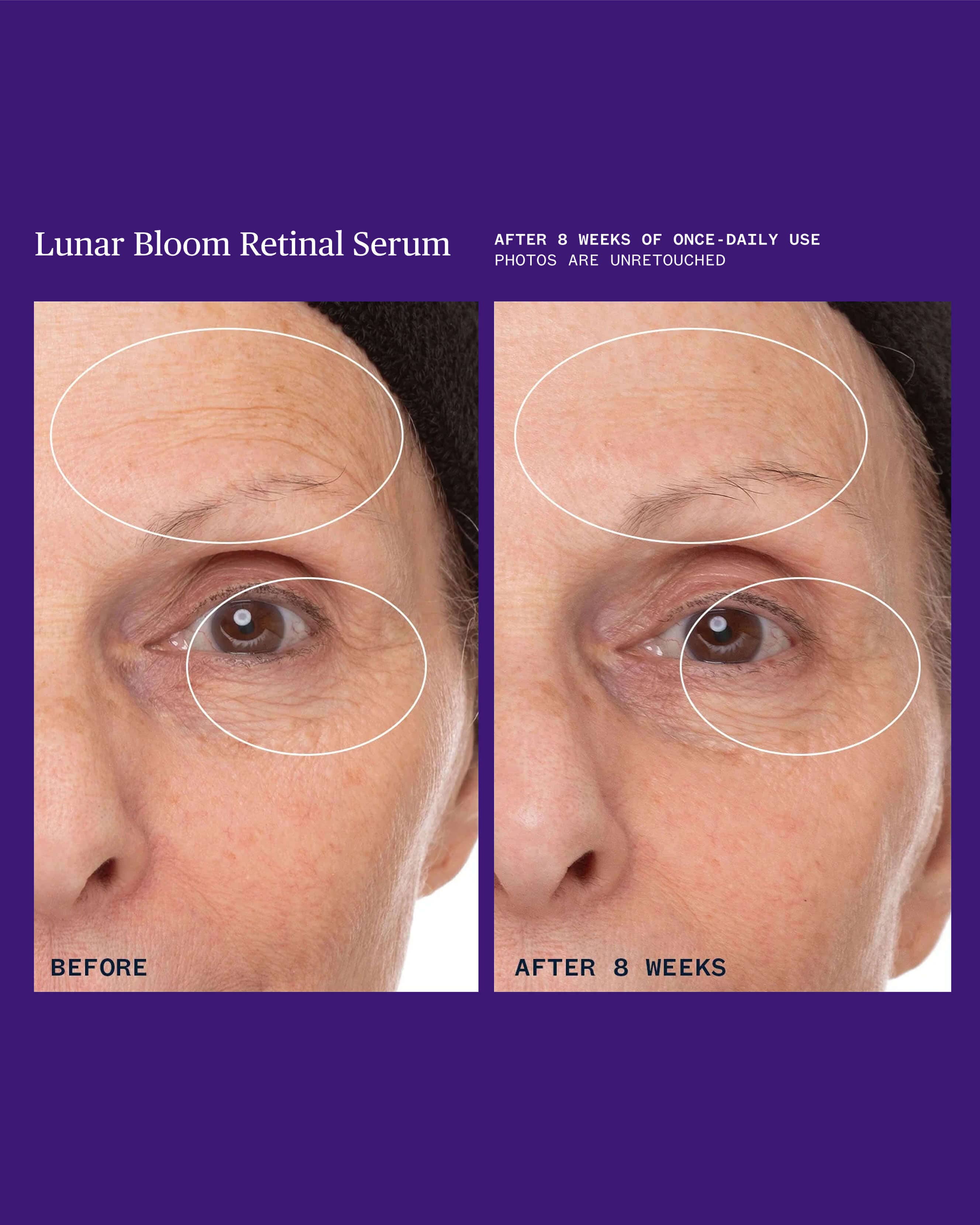 Lunar Bloom Retinal Serum 9