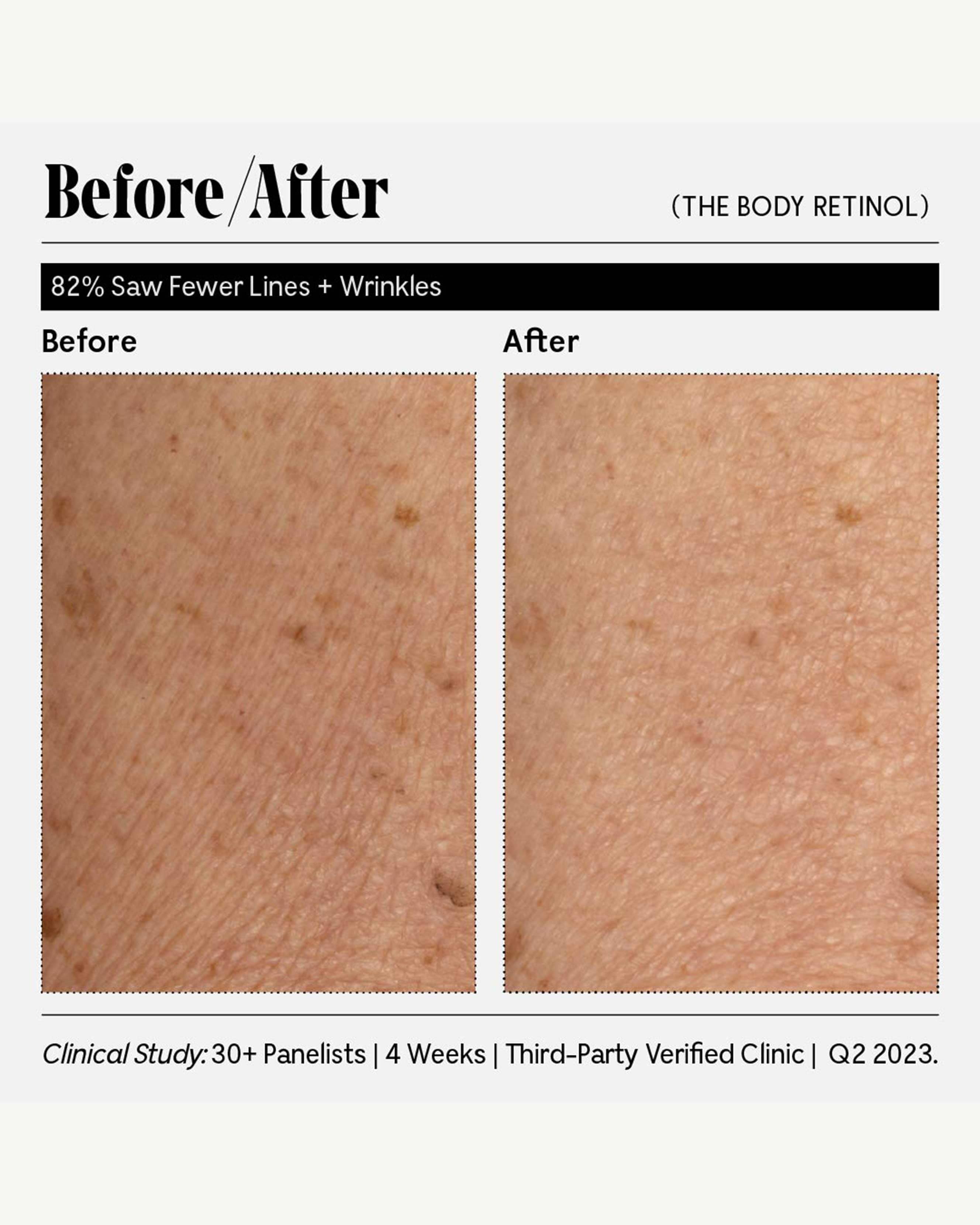 The Body Treatment Duo 3