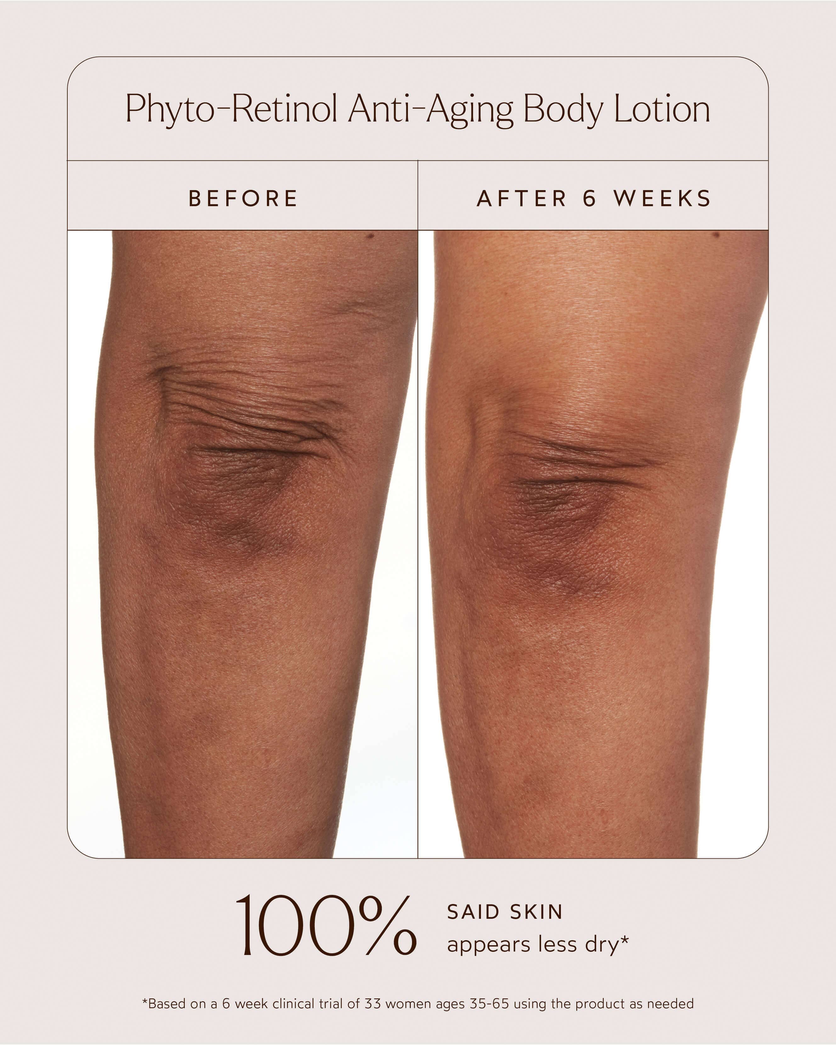 Phyto-Retinol Anti-Aging Body Lotion 9