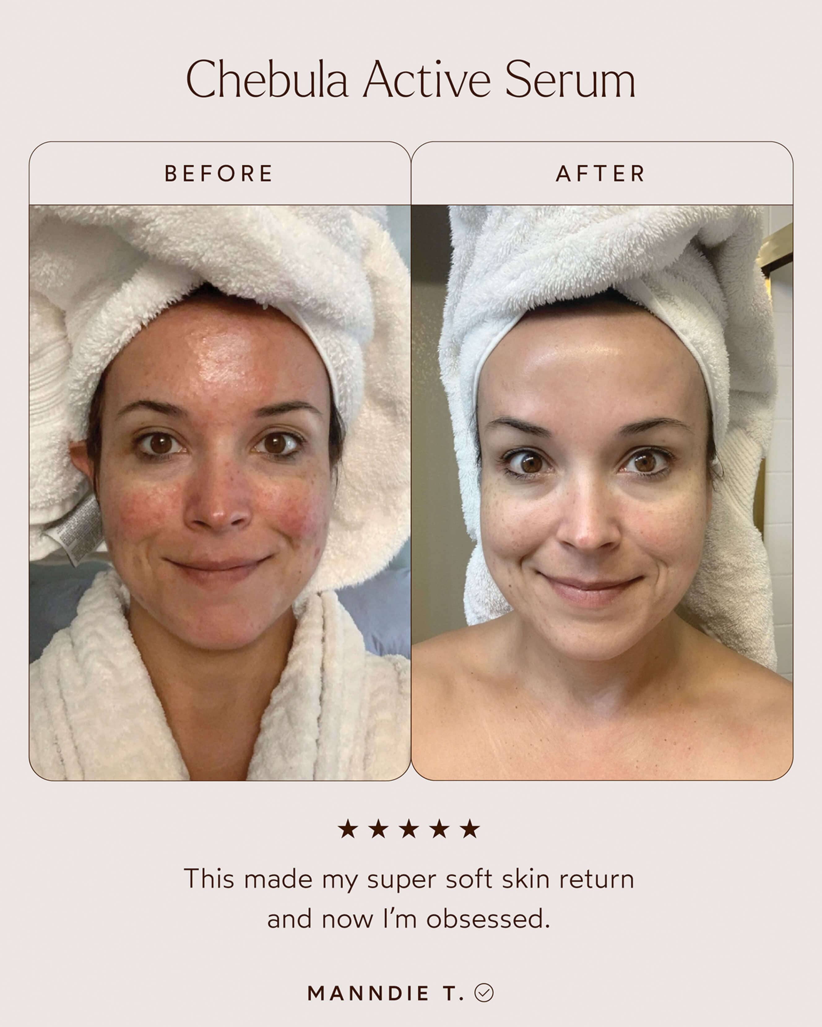 Chebula Active Serum 3