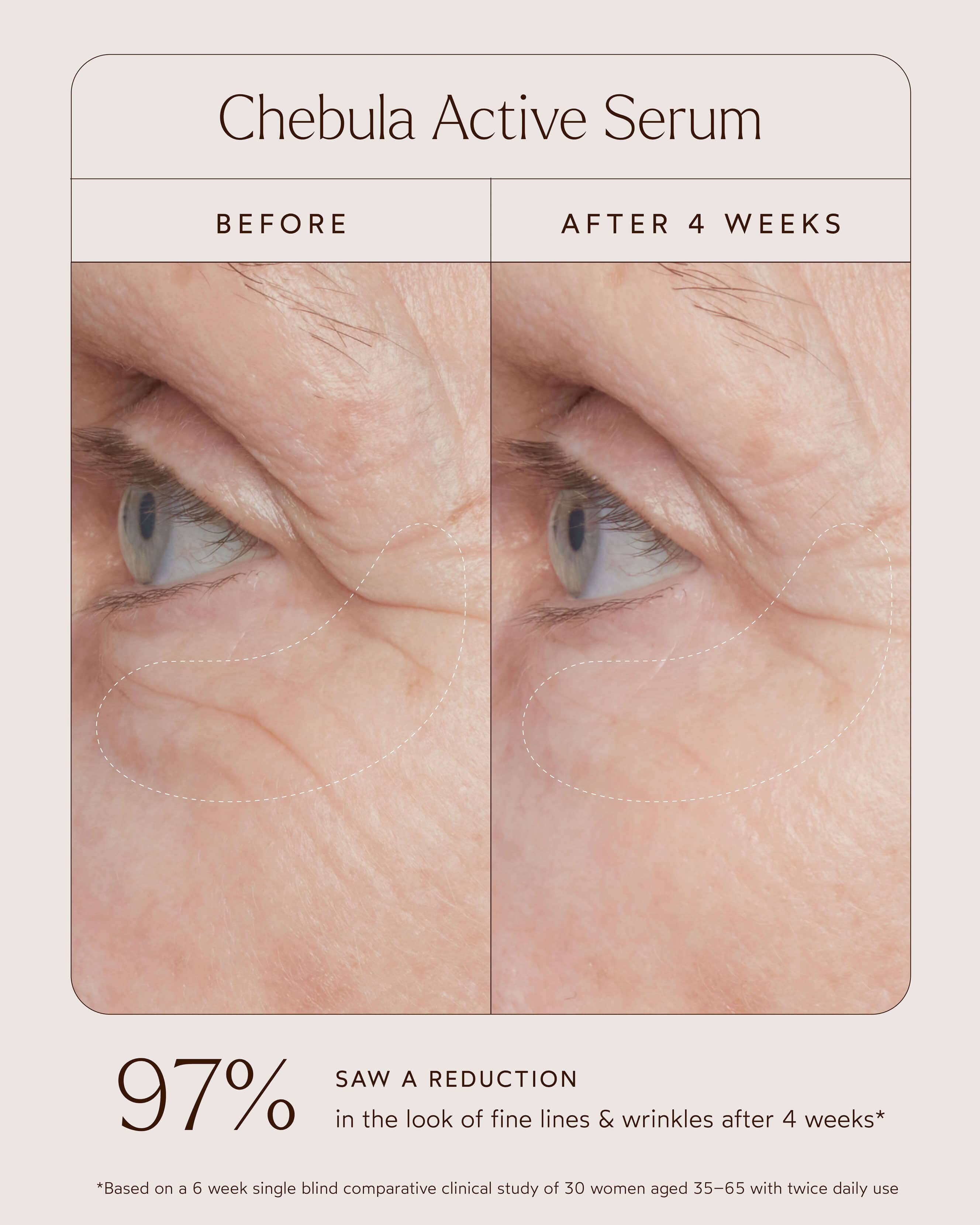 Chebula Active Serum 5