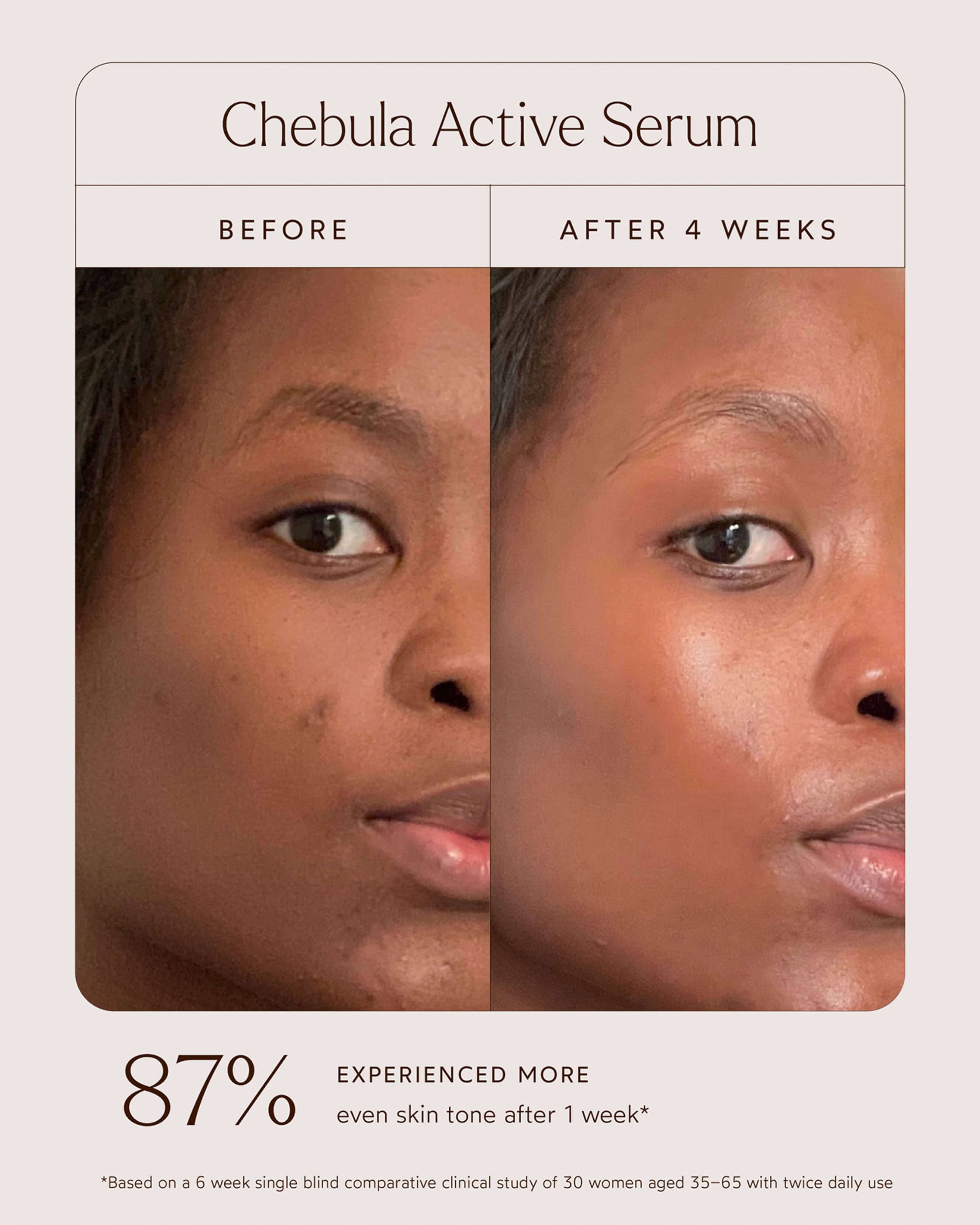 Chebula Active Serum 11