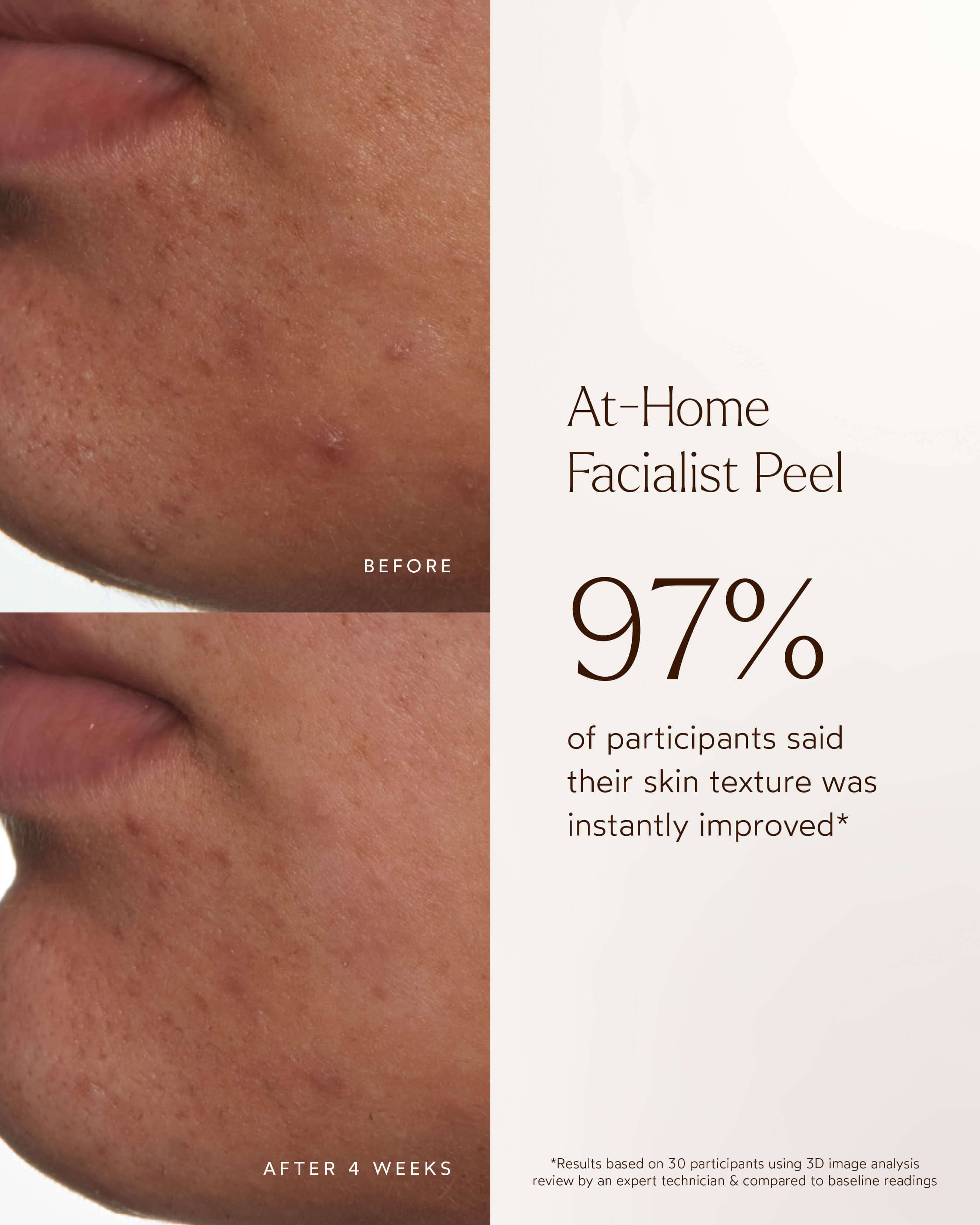 At-Home Facialist Peel 8