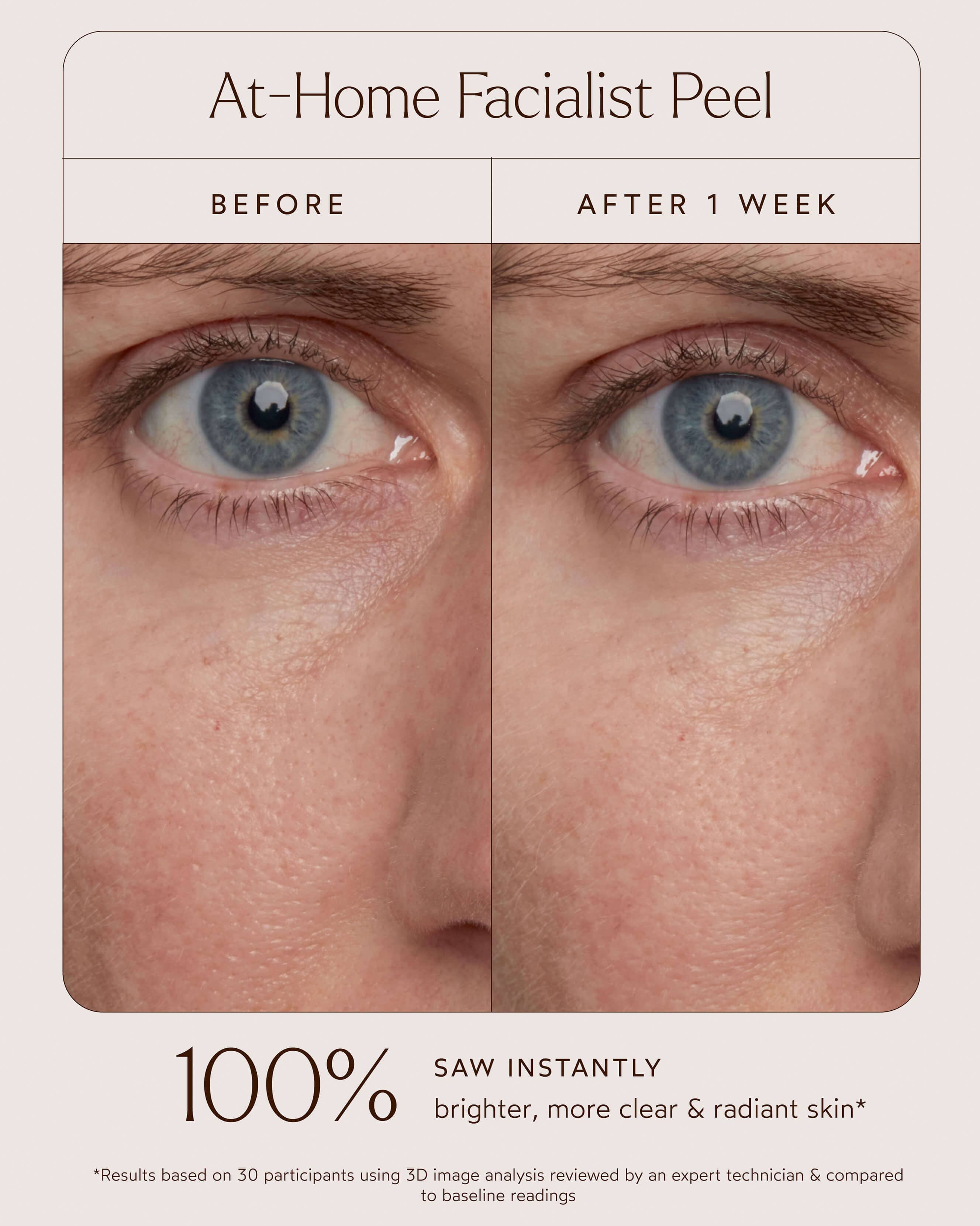 At-Home Facialist Peel 5