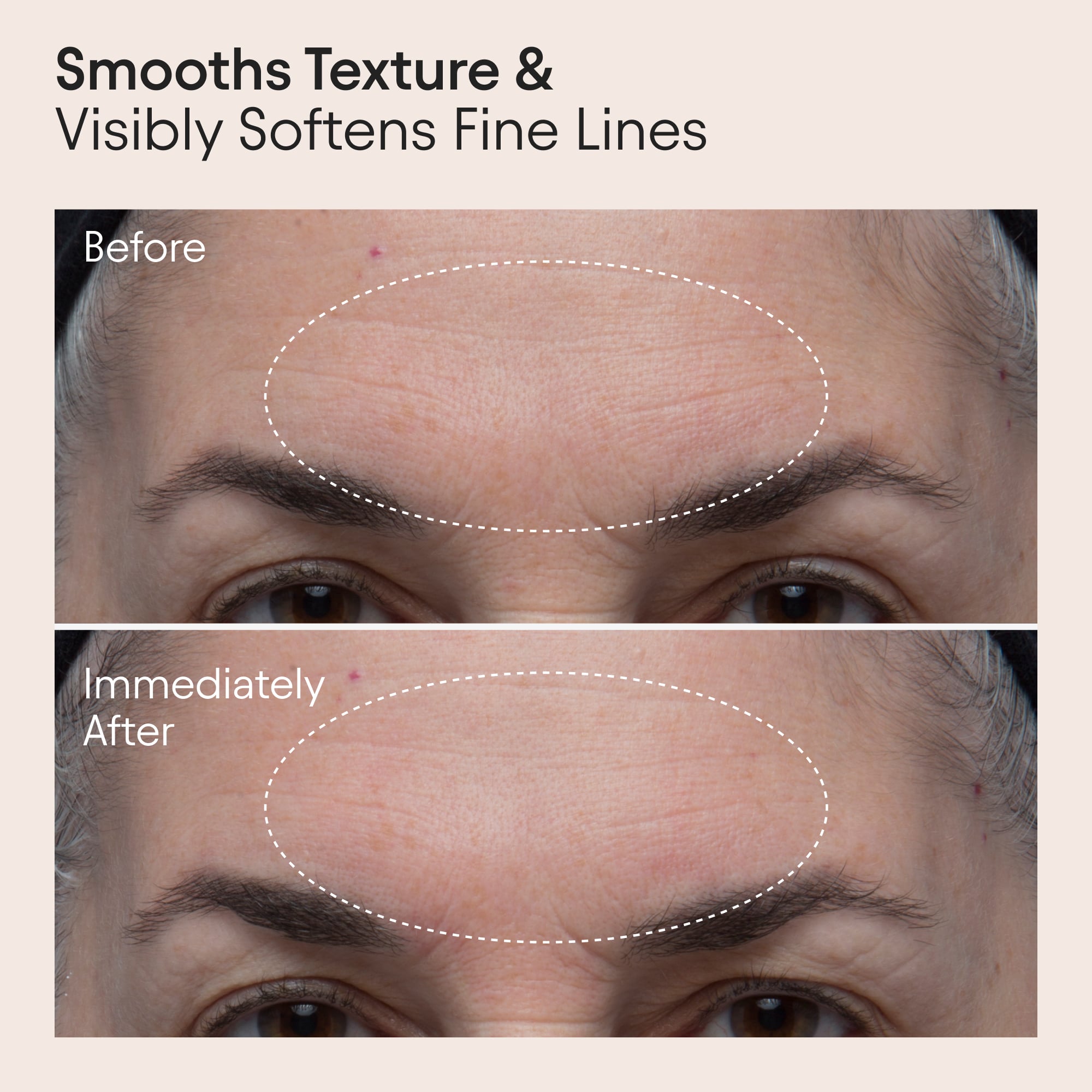 Double Polishing Peel 3