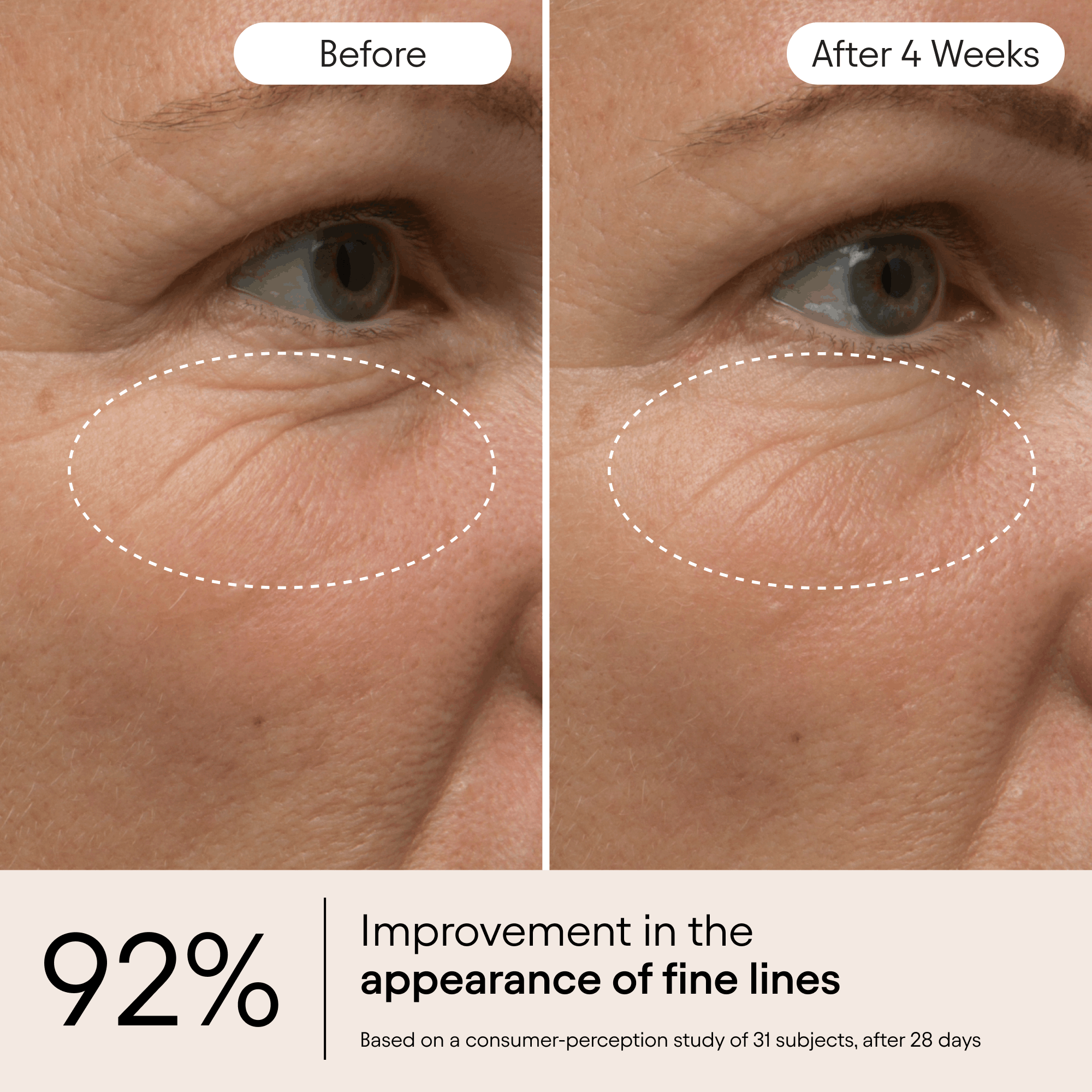 Line-Filling Eye Balm 5