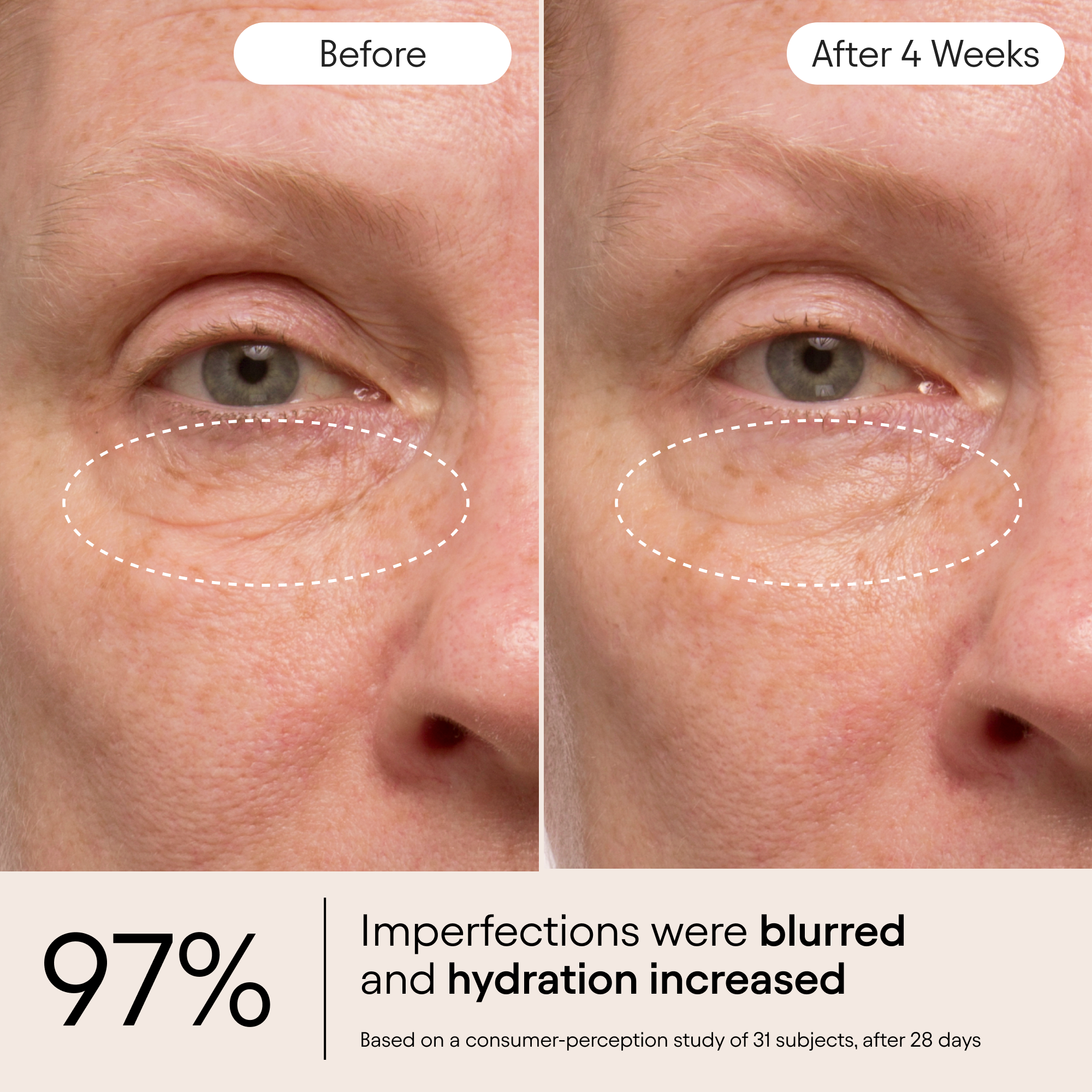 Instant Bright Eye 5