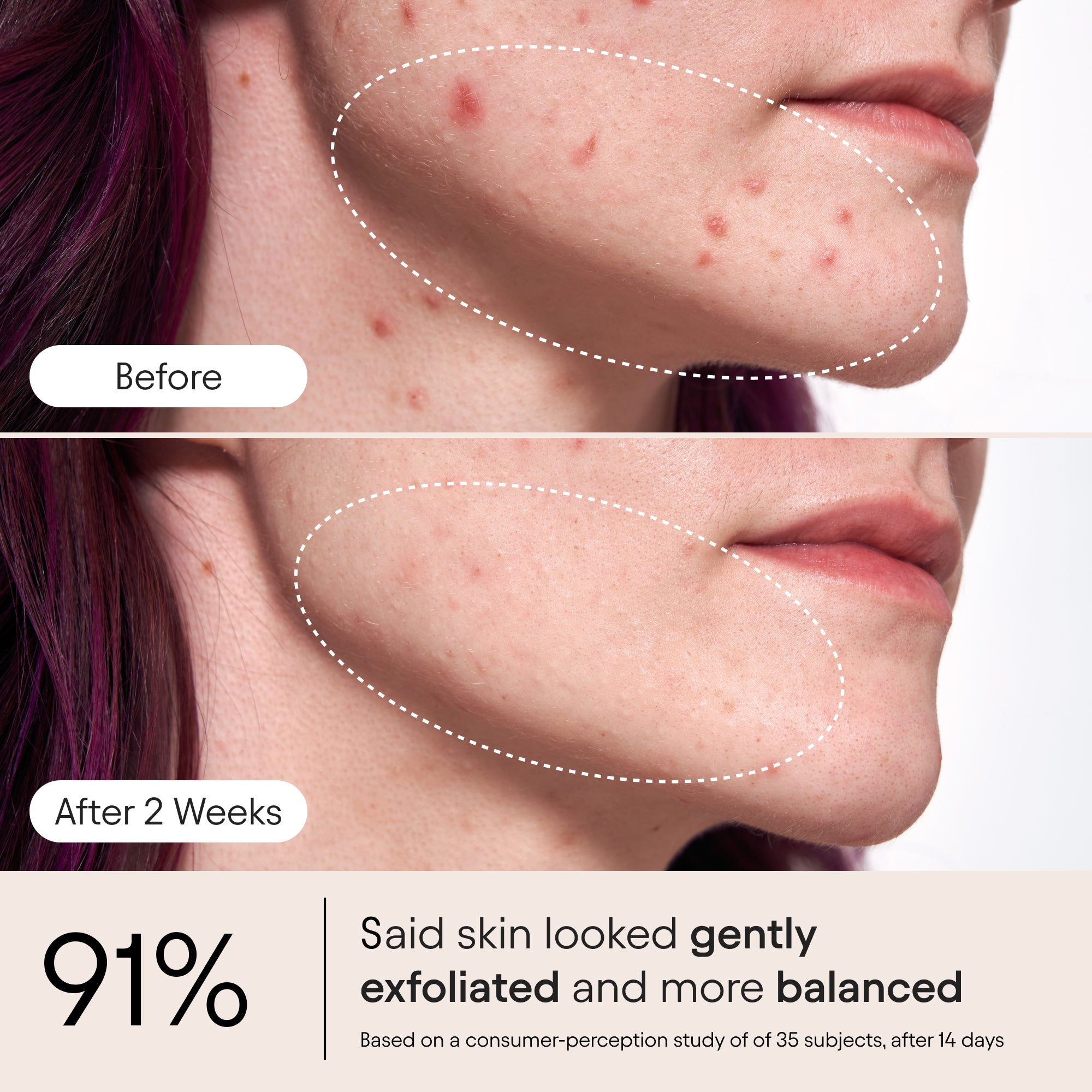 Pore Perfecting Liquid 3