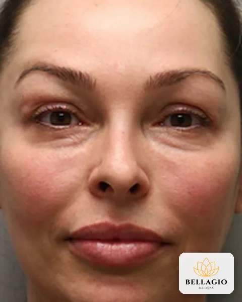 Face before PRP: dull, uneven tone