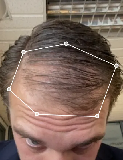 Matt before