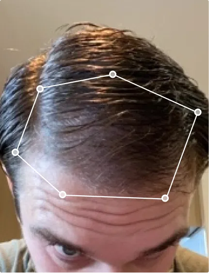Matt after