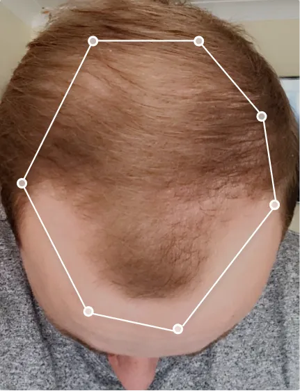 Luke before