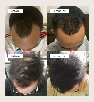 Complete Hair Plan