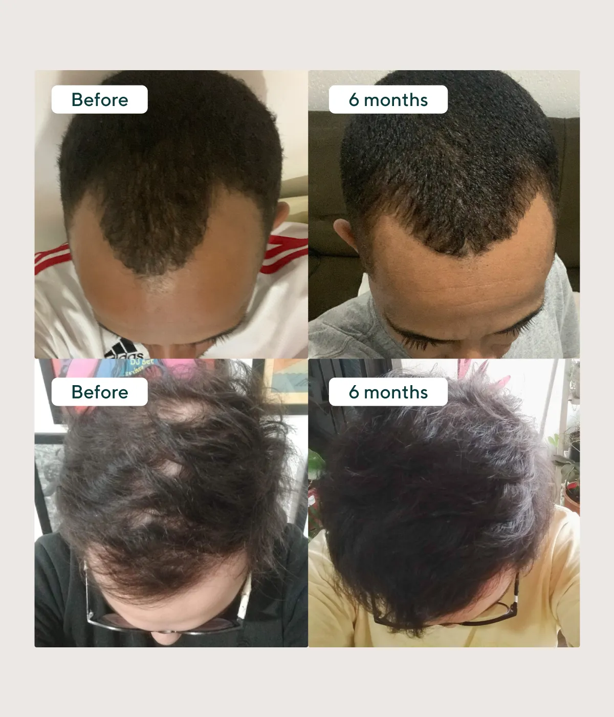 Complete Hair Plan