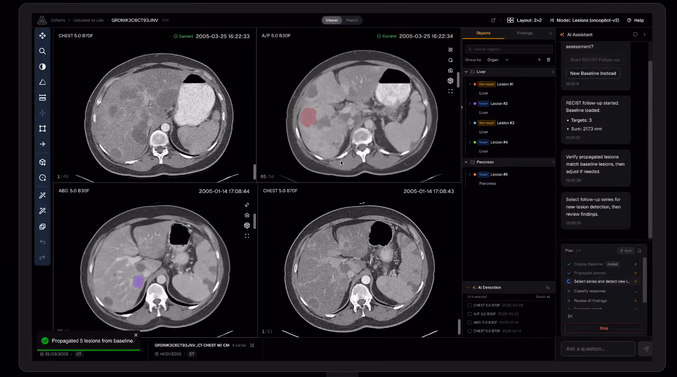 Raidium lance une plateforme de radiologie intégrant l'IA dans les centres de cancérologie américains