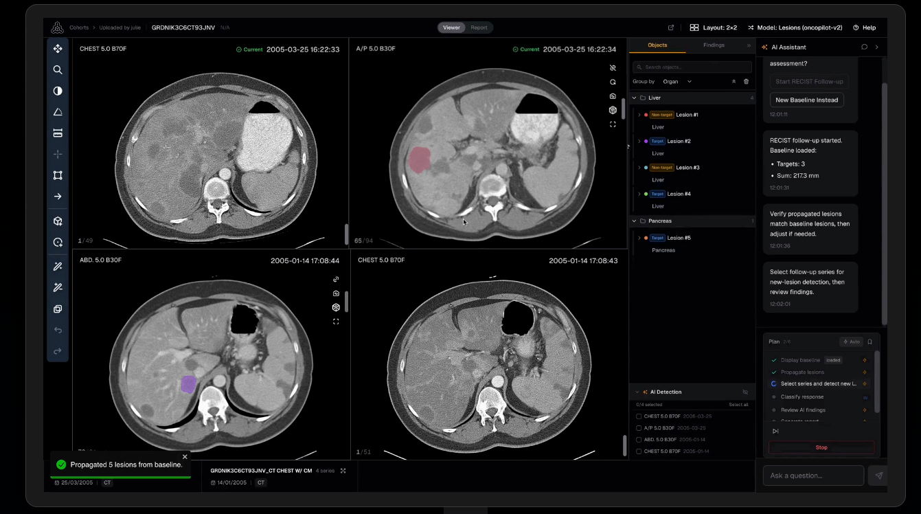 Raidium Launches AI-Native Radiology Platform Across US Cancer Centers