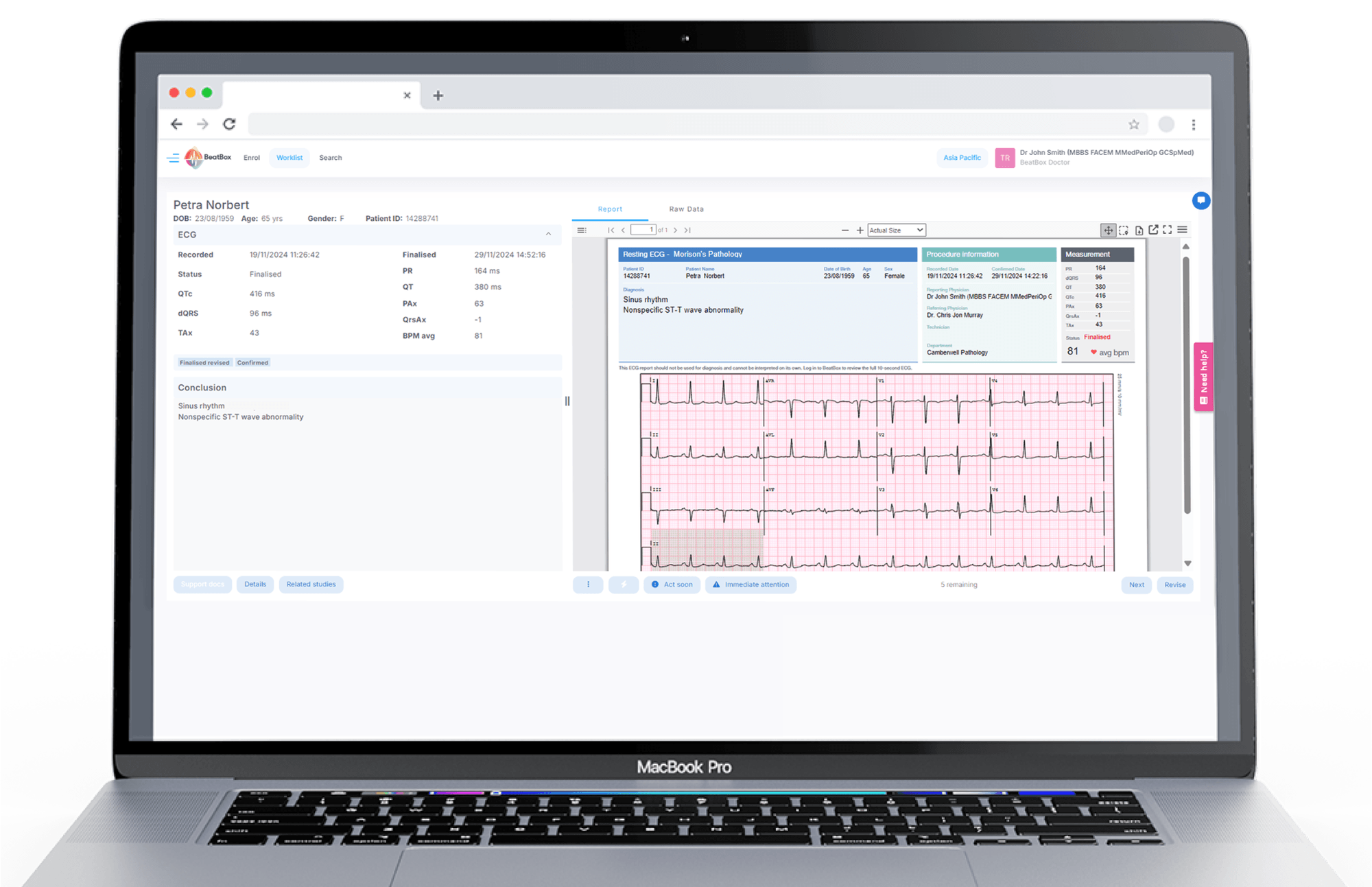 Cardioscan Home — CardioScan
