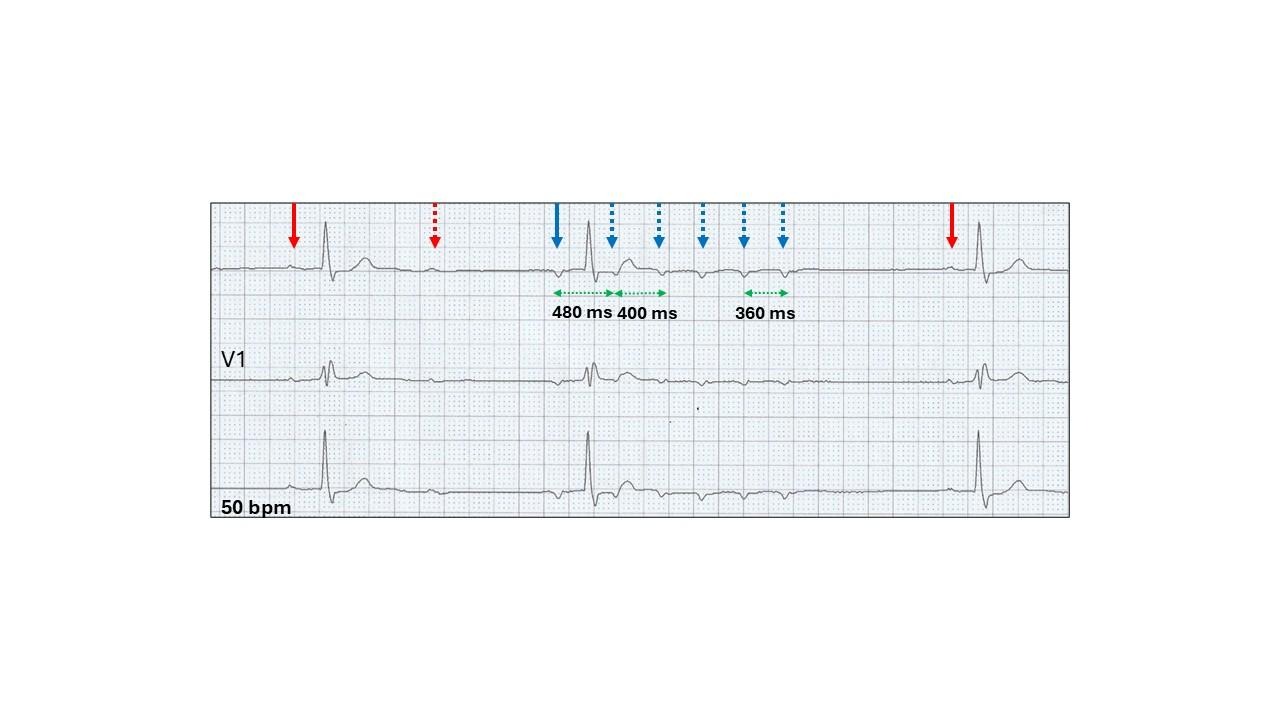 A graph with arrows and linesDescription automatically generated with medium confidence