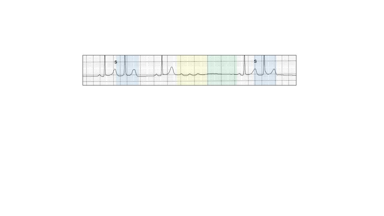 A close-up of a graphDescription automatically generated
