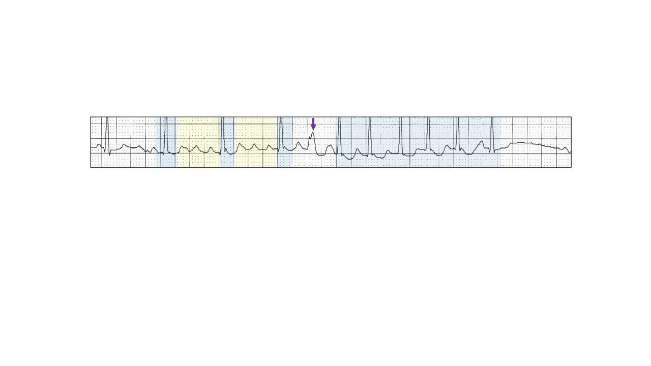 A close-up of a graphDescription automatically generated