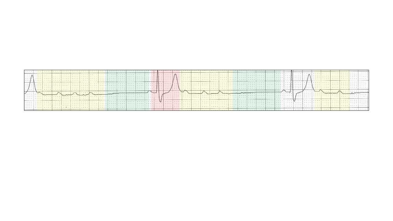 A close-up of a graphDescription automatically generated