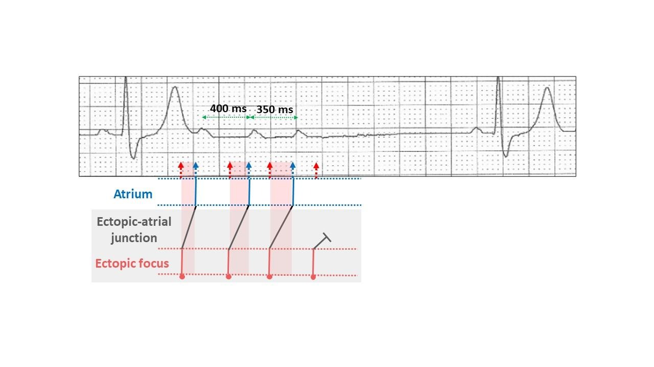 A diagram of a heart rateDescription automatically generated