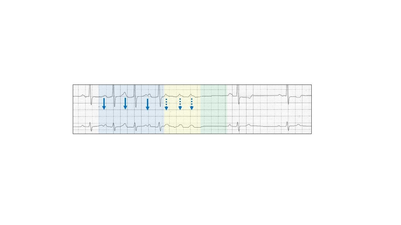 A close-up of a graphDescription automatically generated