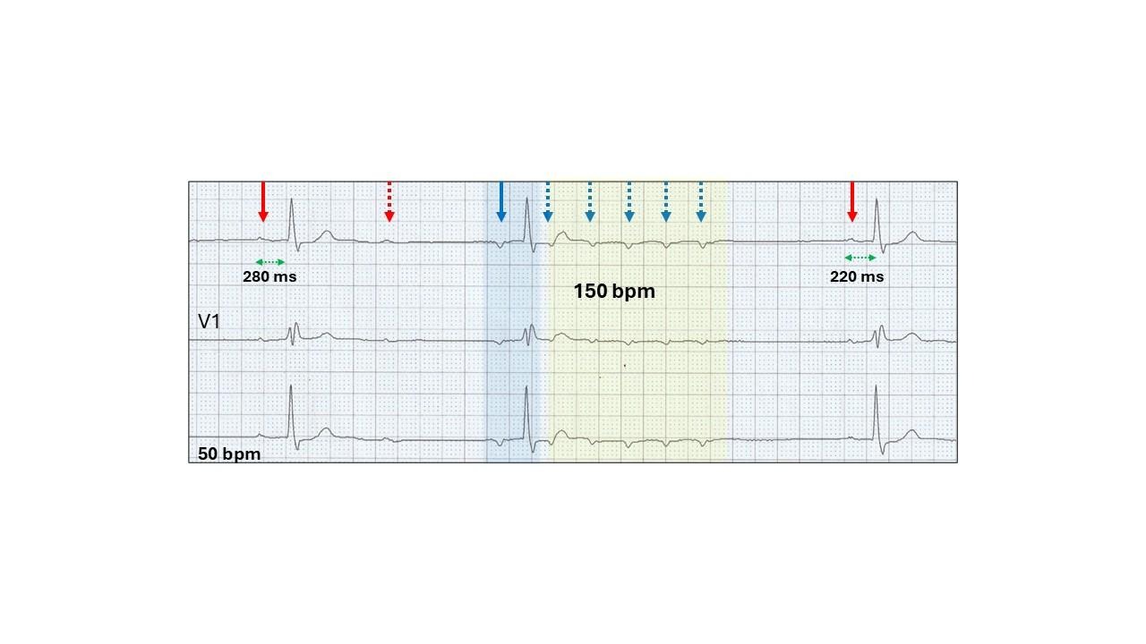 A graph with lines and arrowsDescription automatically generated with medium confidence
