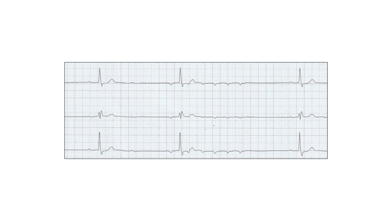 A graph with a graph on itDescription automatically generated with medium confidence