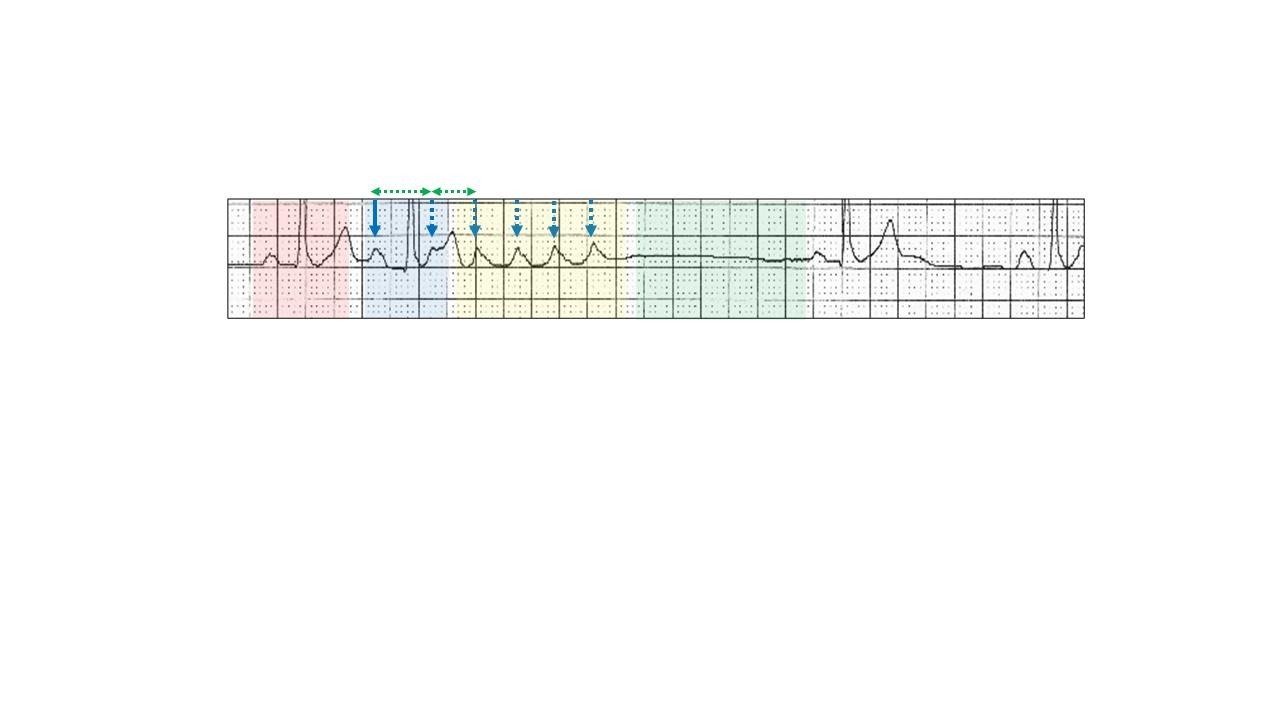 A close-up of a graphDescription automatically generated