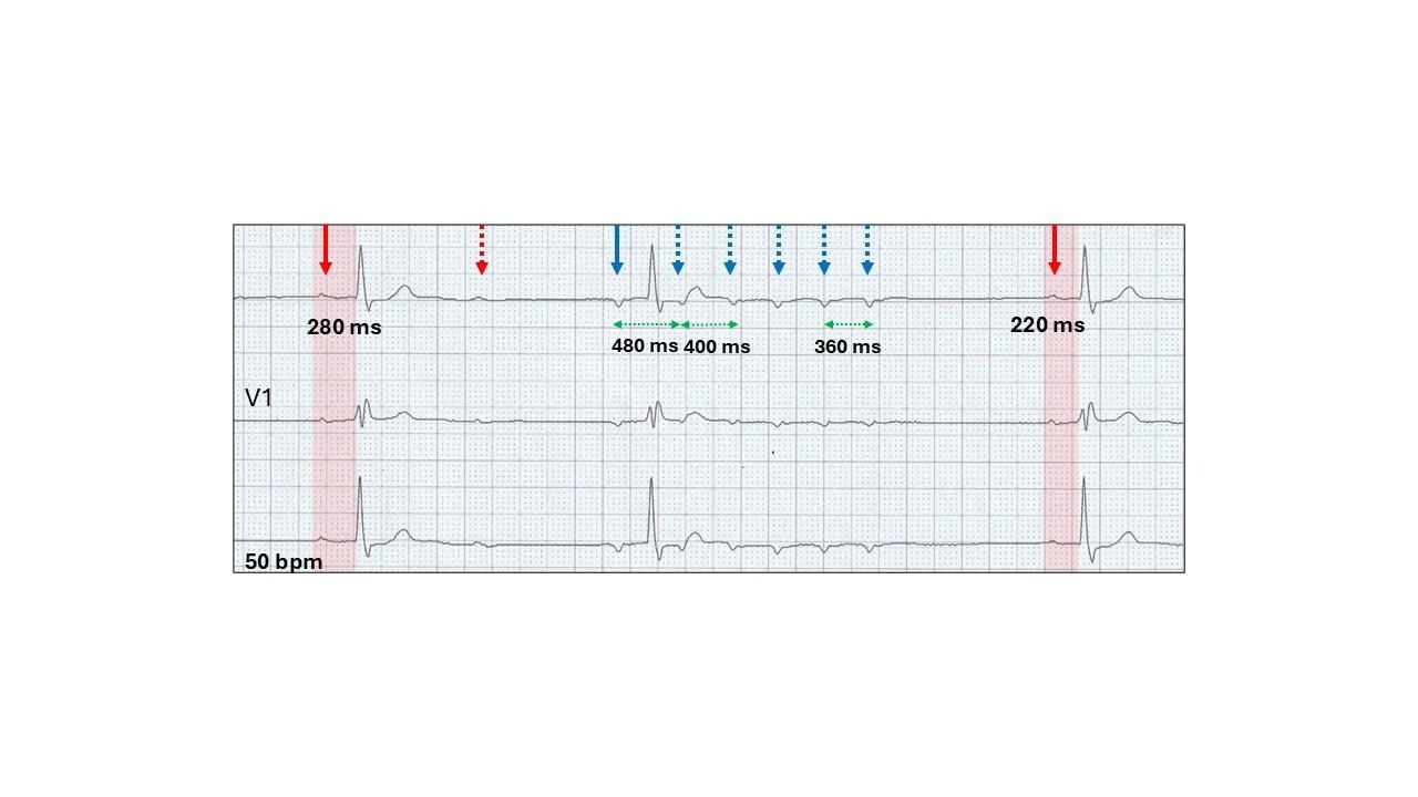 A graph with arrows and linesDescription automatically generated with medium confidence
