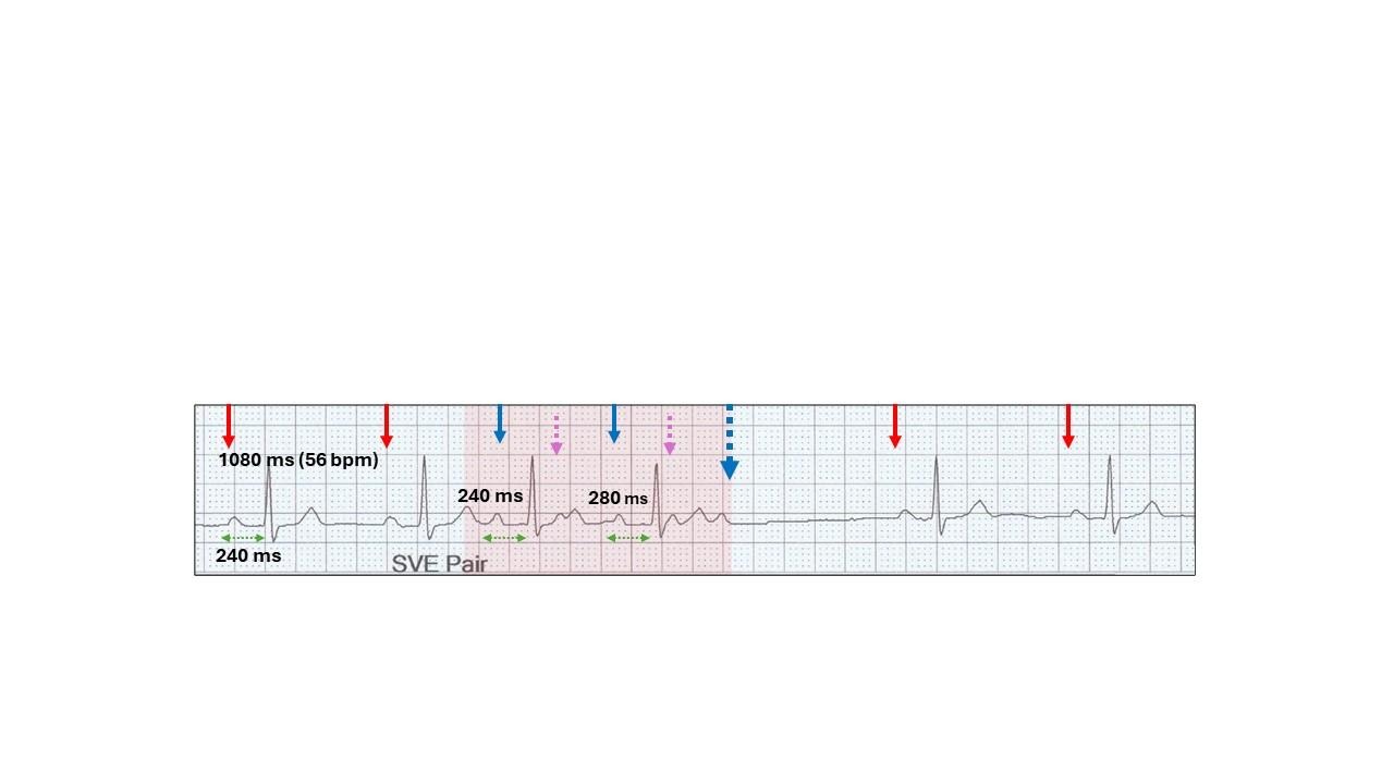A graph with a graph and arrowsAI-generated content may be incorrect.