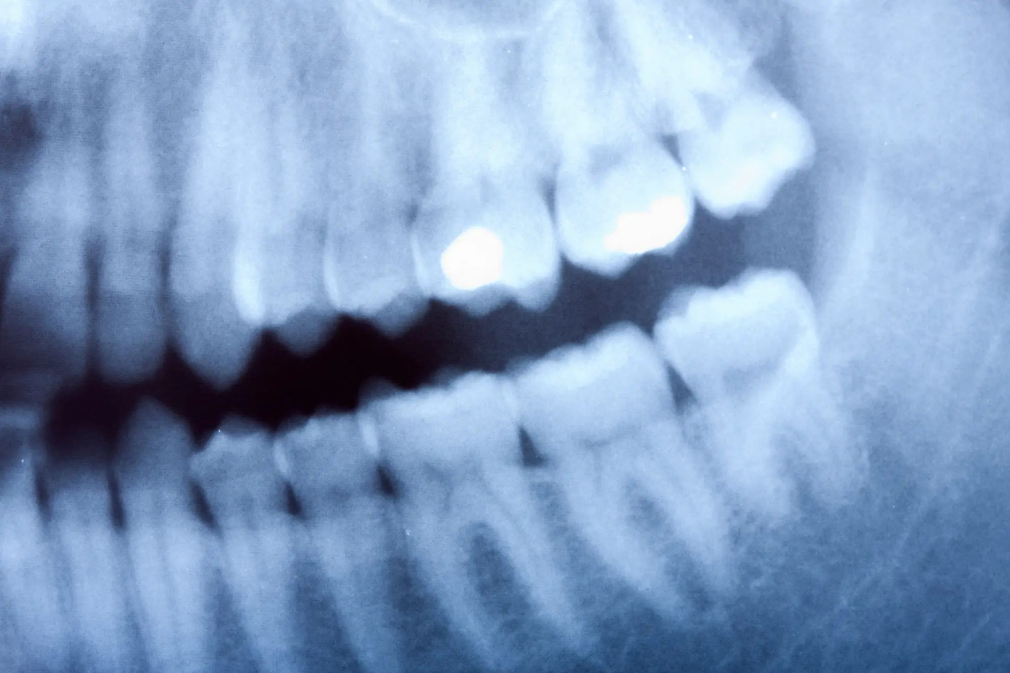 AI Dental X-Ray Analysis: Transforming Diagnostics While Clinicians Lead