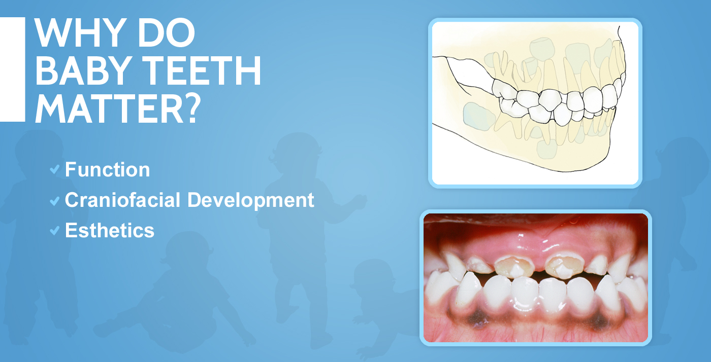 Why do baby teeth matter? paris dental