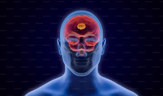 head injury