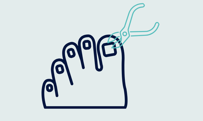 Nail Care, Hard Skin, Corns