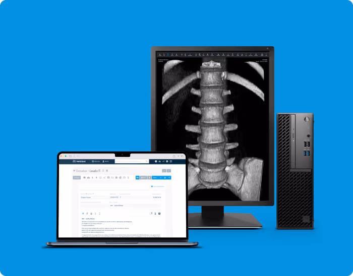 Computador de mesa, monitor exibindo imagem de coluna vertebral em tomografia, e notebook mostrando tela de laudo médico.